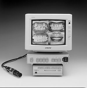 オサダマルチスプリッタ